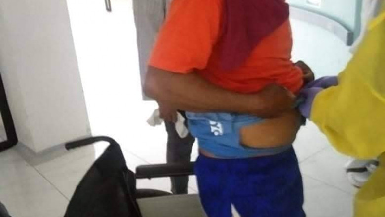 Fisherman hit by Blue Marlin’s bill in Davao Oriental