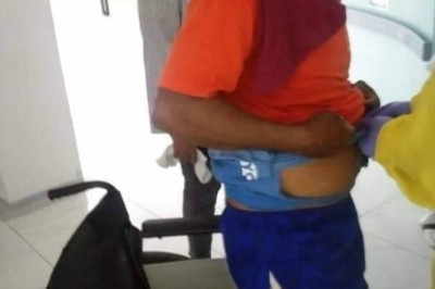 Fisherman hit by Blue Marlin’s bill in Davao Oriental